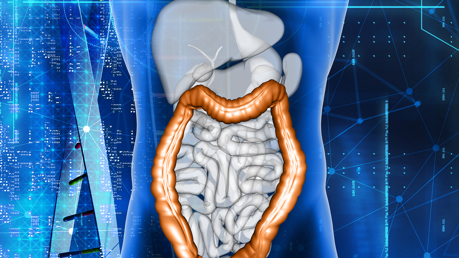 I tumori del colon-retto 