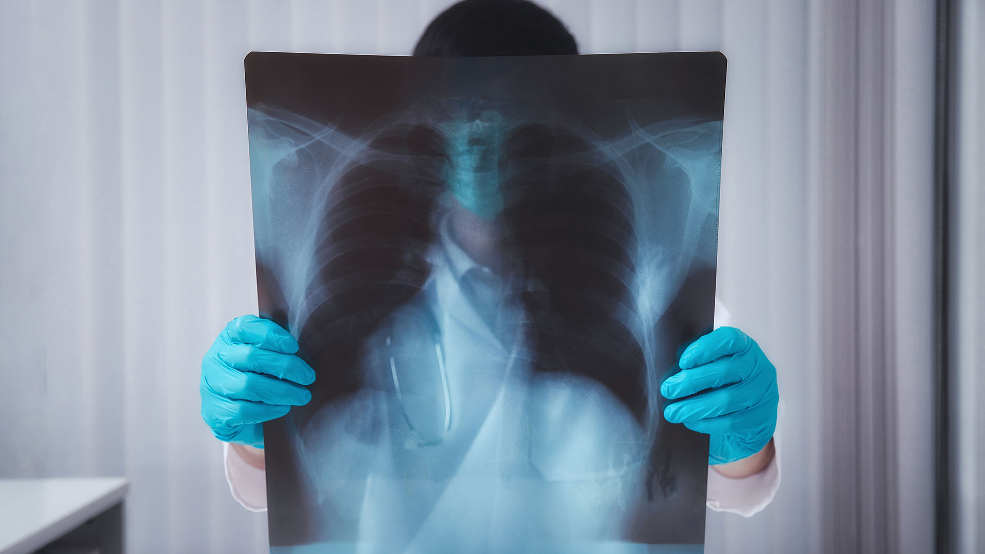 Il reparto di radiologia dell’ospedale di Esine