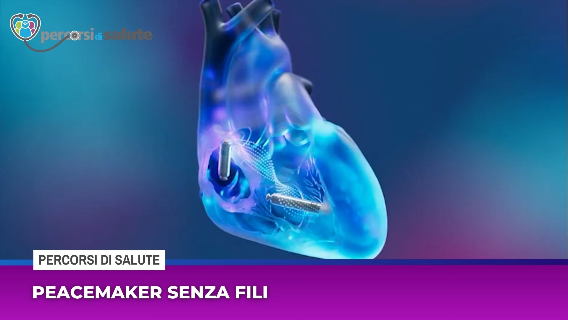 Peacemaker senza fili