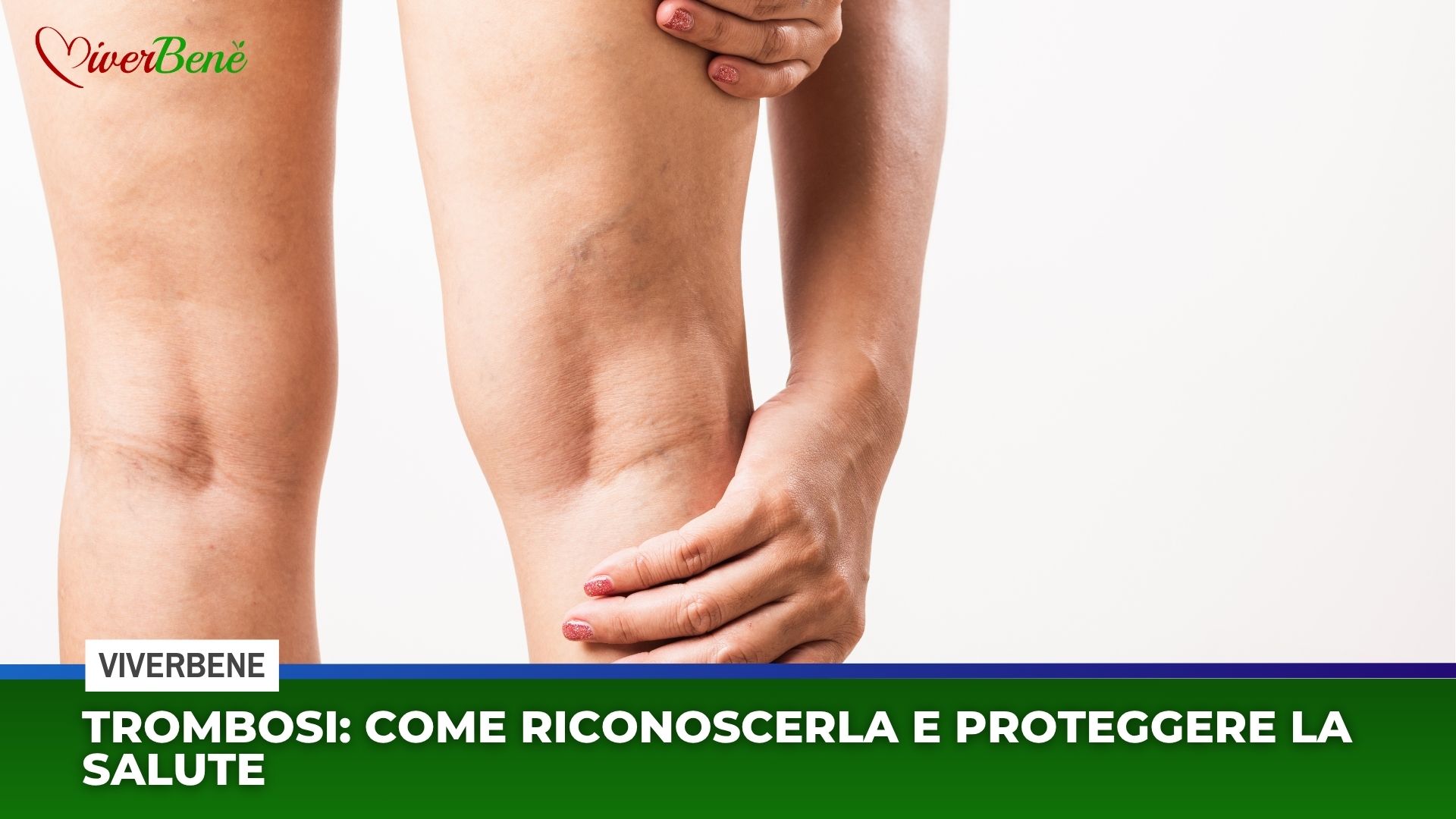 Trombosi: come riconoscerla e proteggere la salute