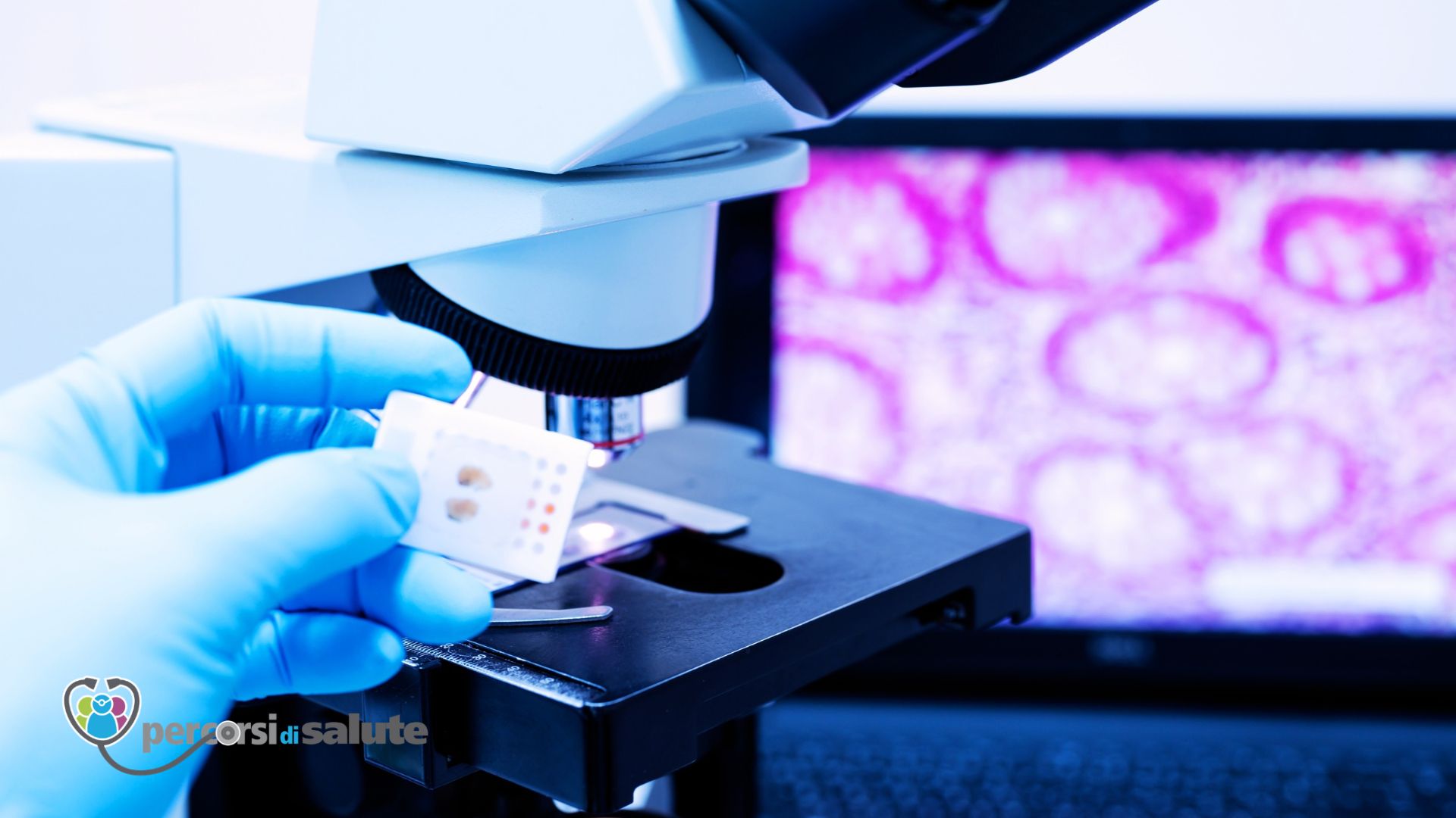 Anatomia patologica: il laboratorio che cerca la malattia e trova la cura