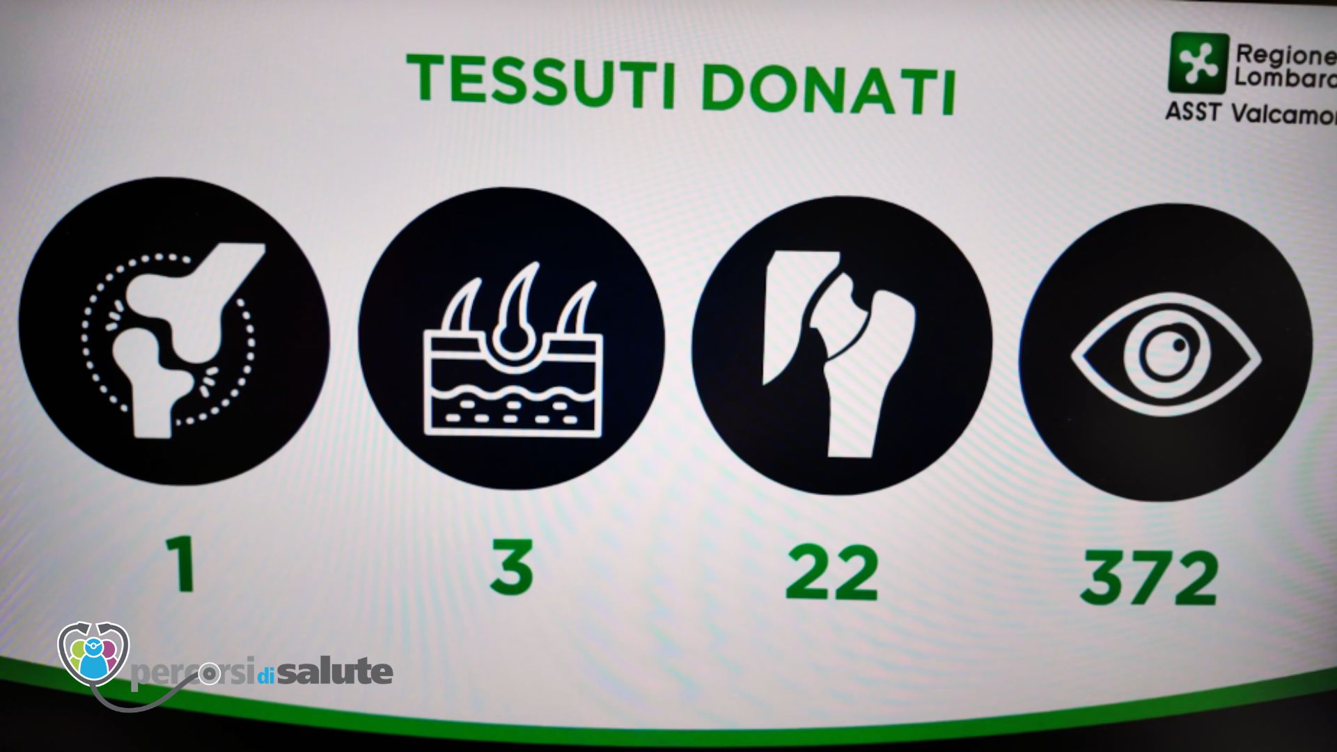Esine, l’ospedale che dona