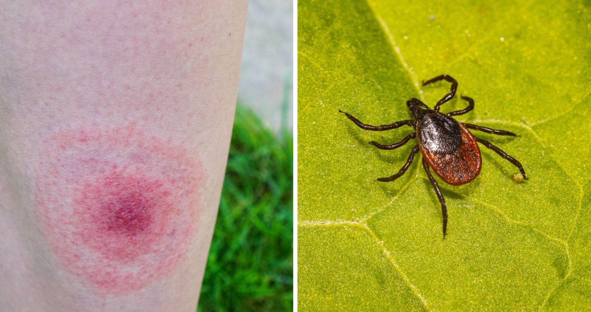 Come difendersi dalle zecche