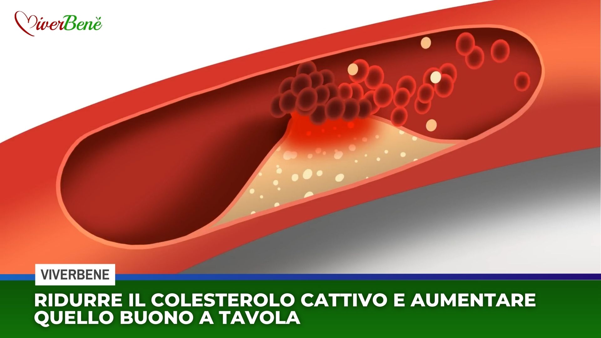 Colesterolo: ridurre quello cattivo e aumentare quello buono. Cosa fare a tavola