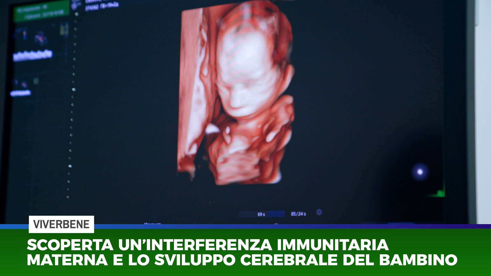 Scoperta un'interferenza immunitaria materna e lo sviluppo cerebrale del bambino