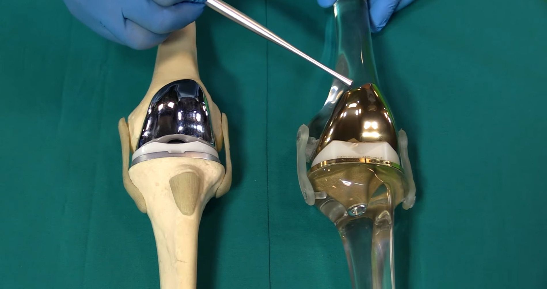 Artrosi: oggi si cura (anche) con l'ortobiologia