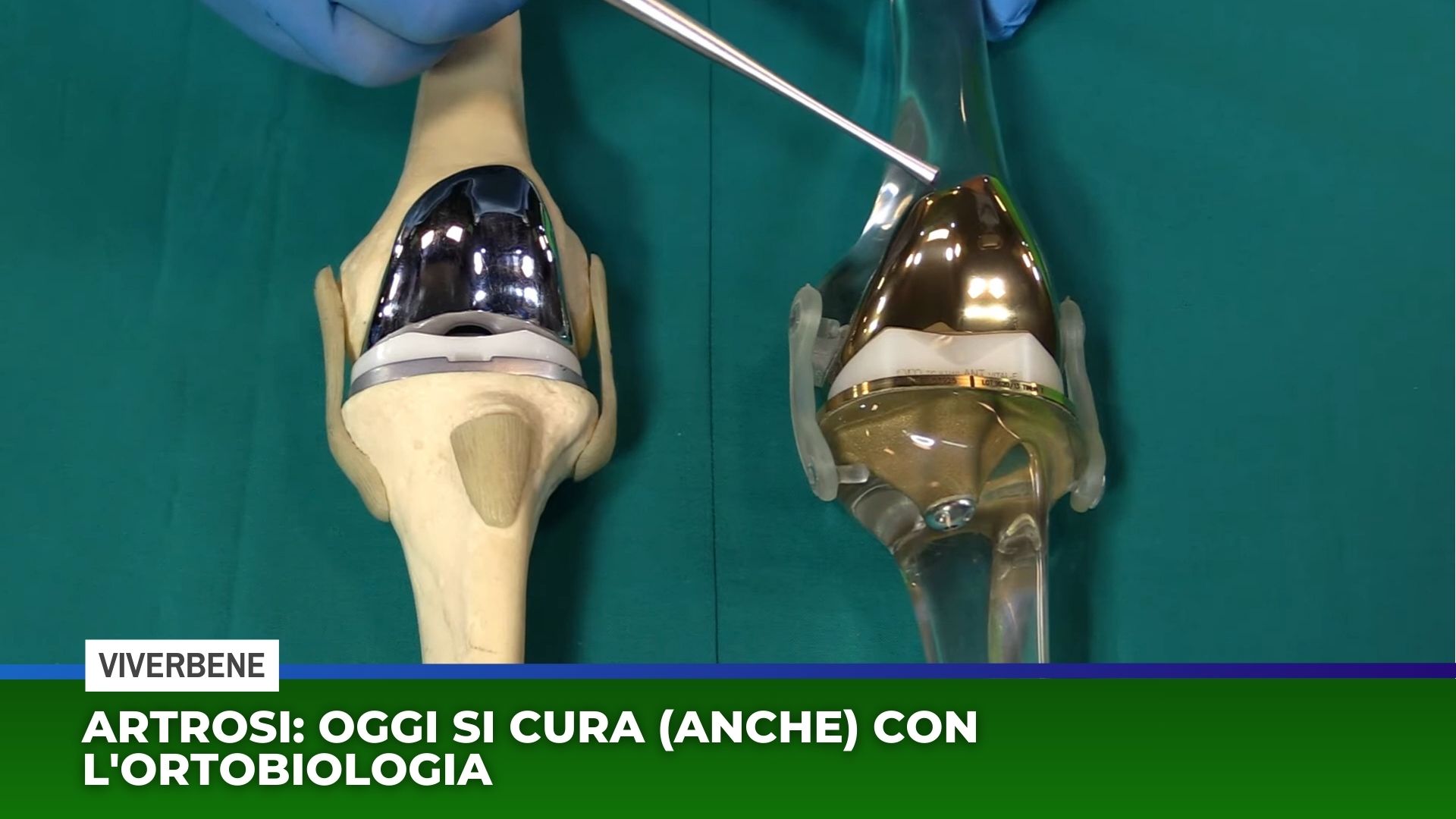 Artrosi: oggi si cura (anche) con l'ortobiologia