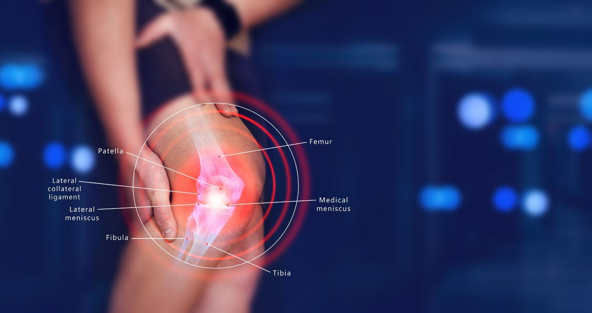 Viverbene: attenzione al menisco