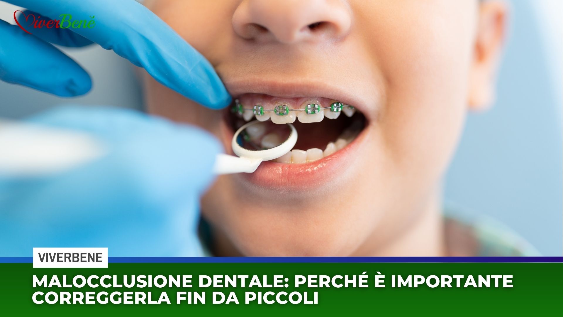 Malocclusione dentale: perché è importante correggerla fin da piccoli