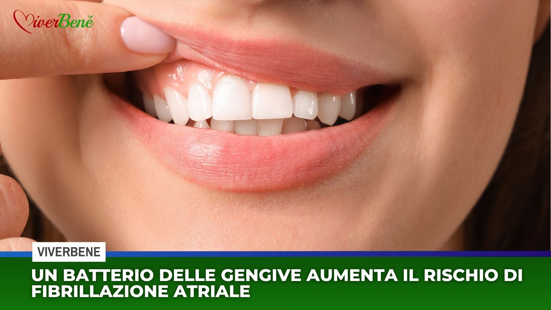 Un batterio delle gengive aumenta il rischio di fibrillazione atriale