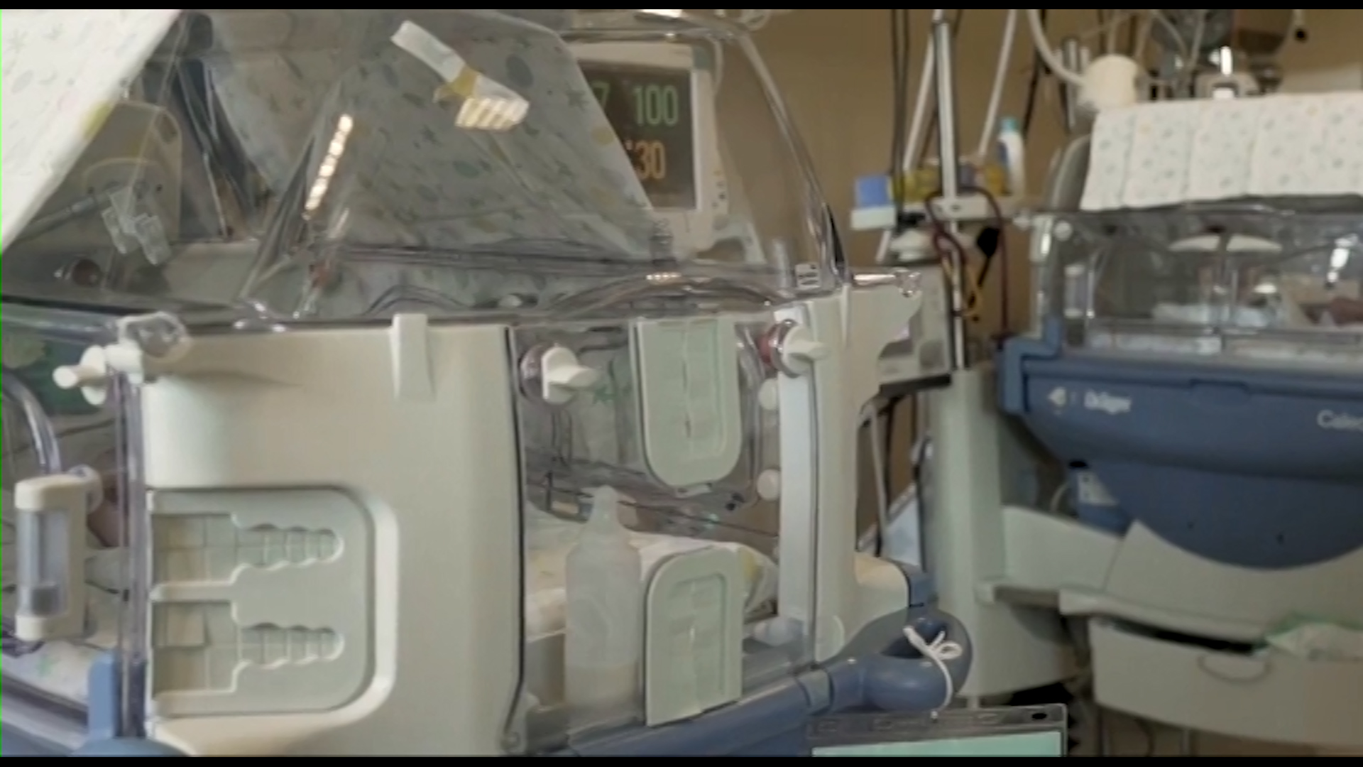 Neonato muore poco dopo il parto