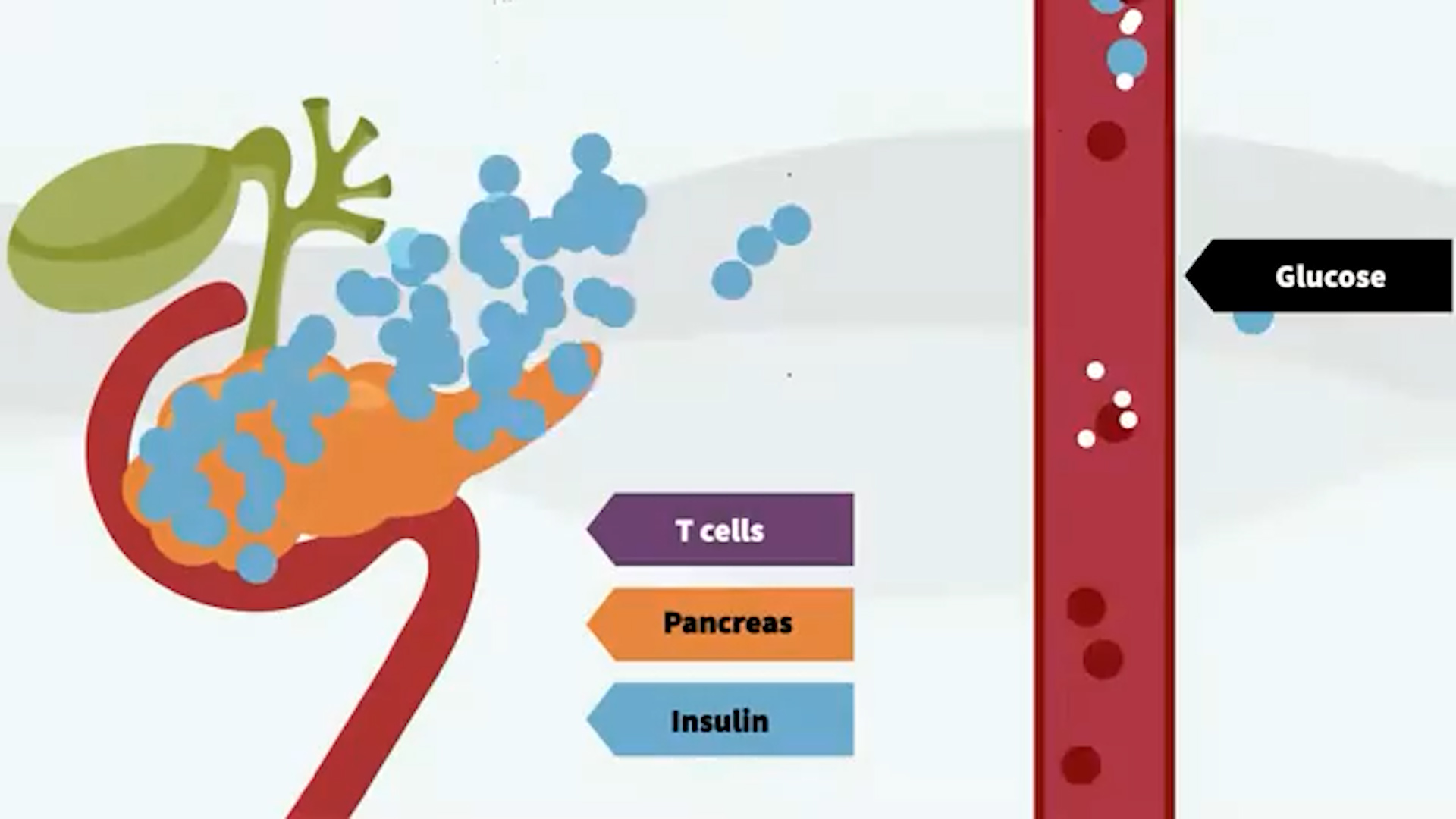 Immunoterapia, staminali e terapia genica. Sono le nuove frontiere nella cura del Diabete di tipo 1