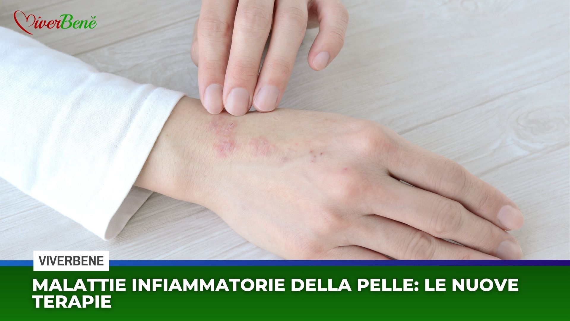 Malattie infiammatorie della pelle: ecco le nuove terapie