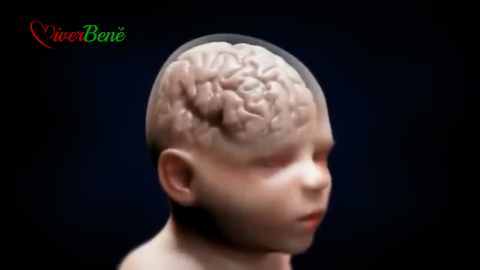 Sindrome del bimbo scosso: spesso diagnosi arriva troppo tardi, serve prevenzione