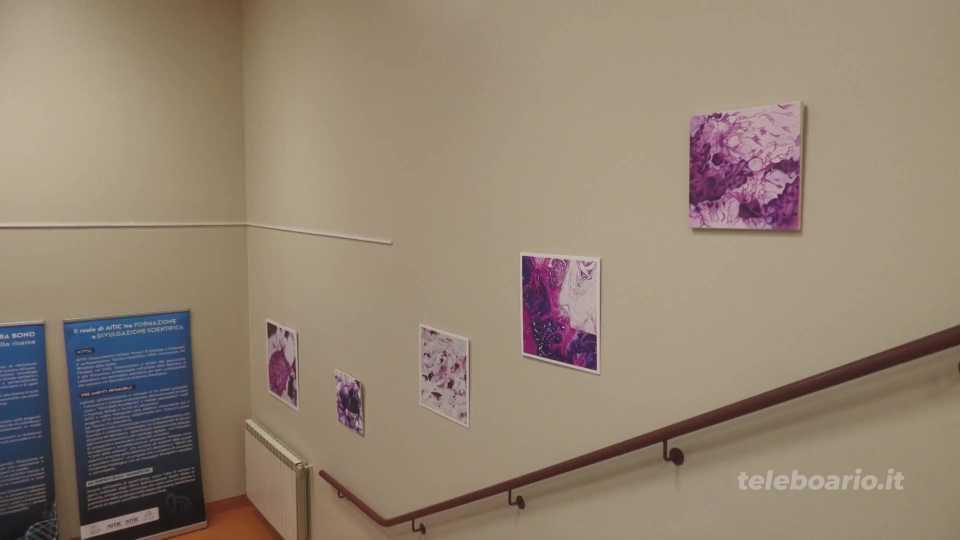 I vetrini istologici diventano una mostra sulle scale dell’ospedale. L’arte come prevenzione